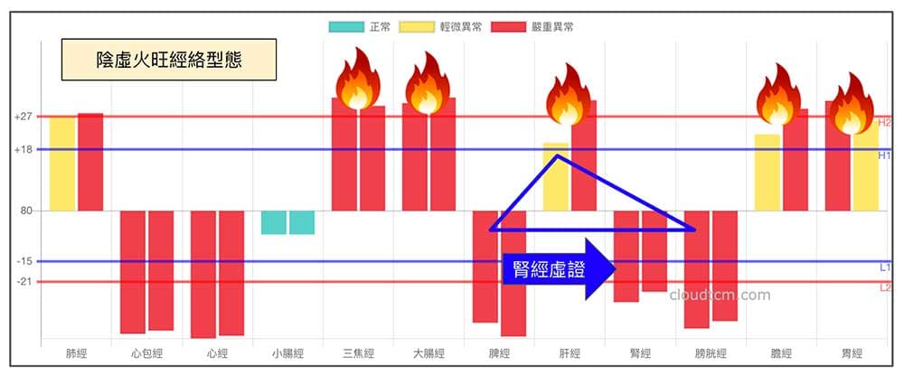 腎陰虛火旺時，最常出現的經絡型態