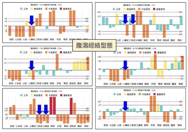 腹瀉的經絡型態，都可以輕易看到手三陽經虛證