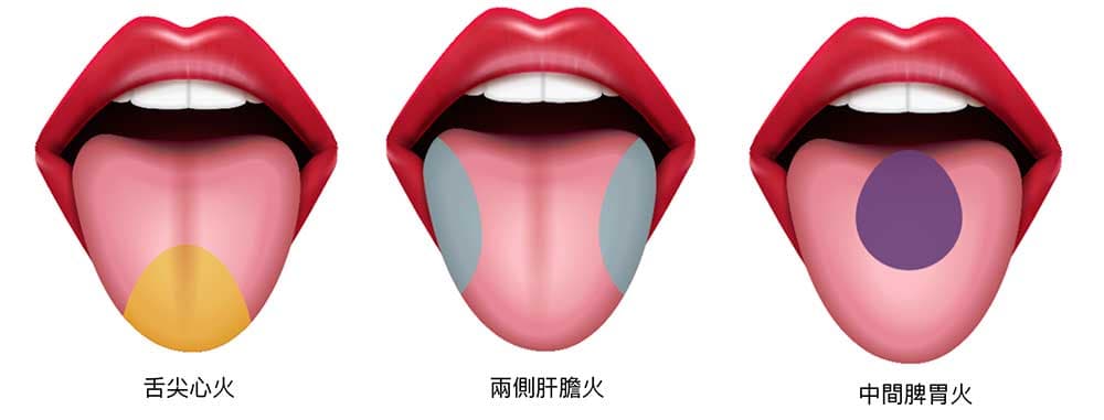 舌痛與臟腑