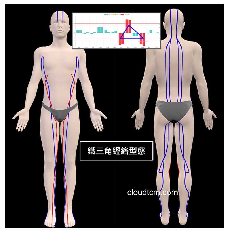 夏季常見的鐵三角經絡型態開啟3D模式