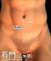 石門