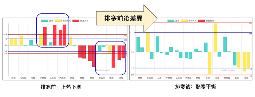 執行排寒養生可以透過經絡加以印證效果