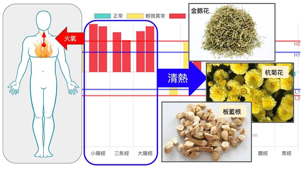 上半身火氣大，造成喉嚨痛