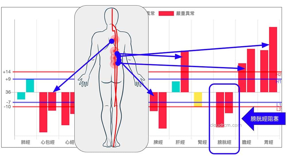 運用經絡檢測，背痛的原因一目瞭然！