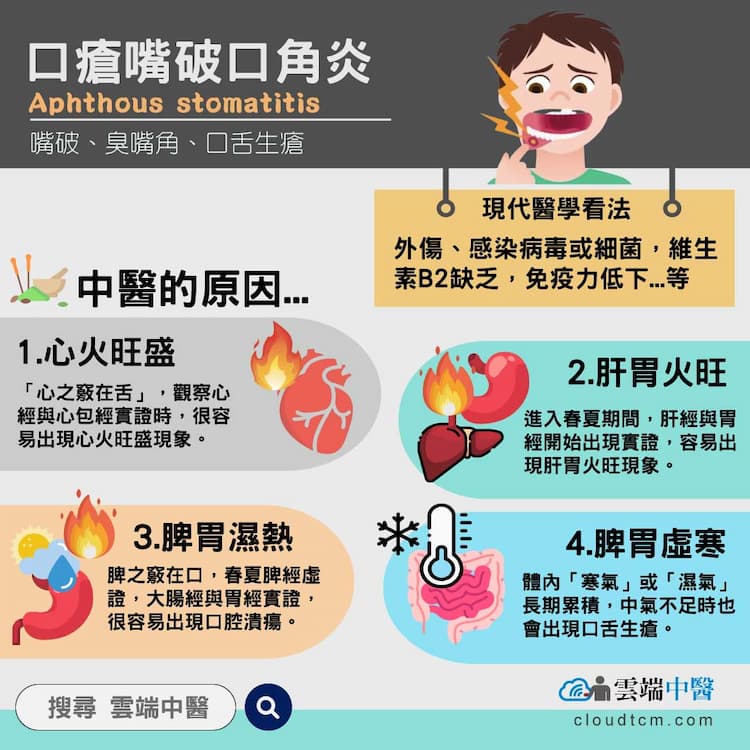 口瘡嘴破口角炎