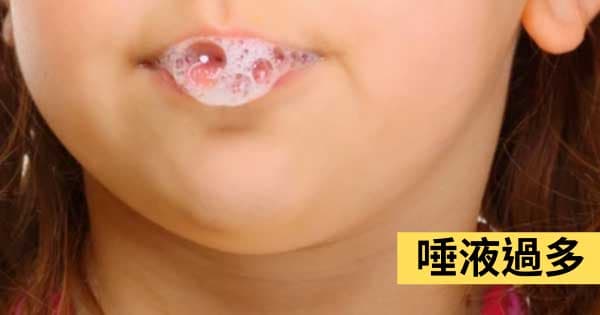 唾液過多