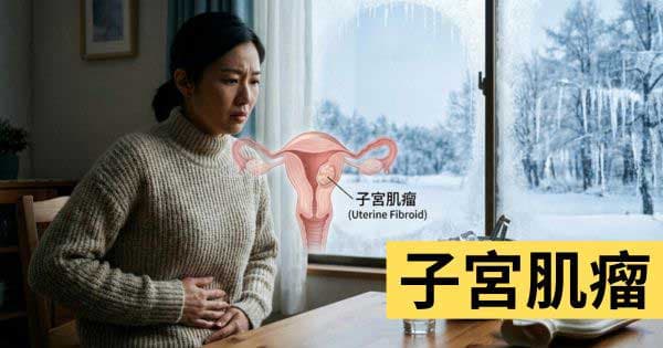 子宮肌瘤
