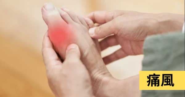 痛風