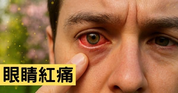 眼睛紅痛
