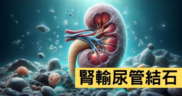 腎及輸尿管結石