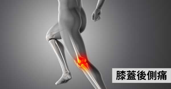 膝蓋後側痛