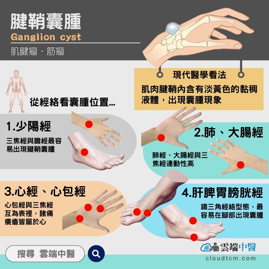 腱鞘囊腫長全身？從中醫證候,經絡與中藥理解！