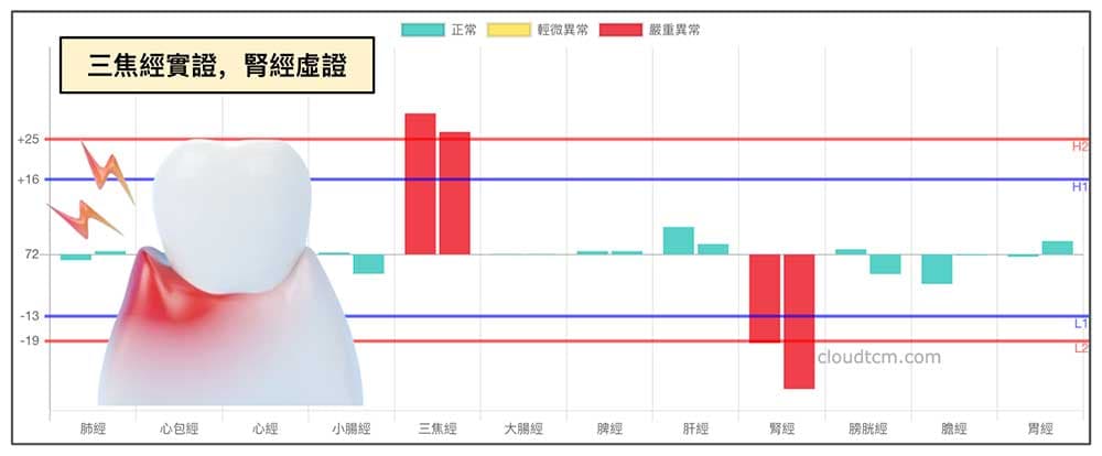 三焦經實證，腎經虛證的經絡現象