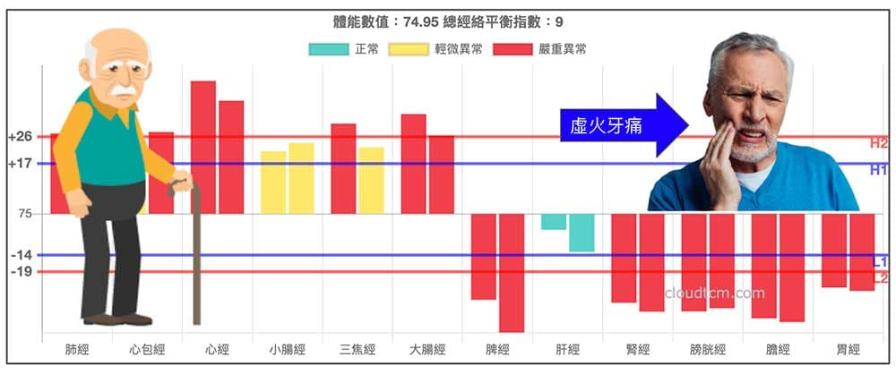 經絡上實下虛時，容易出現虛火牙痛