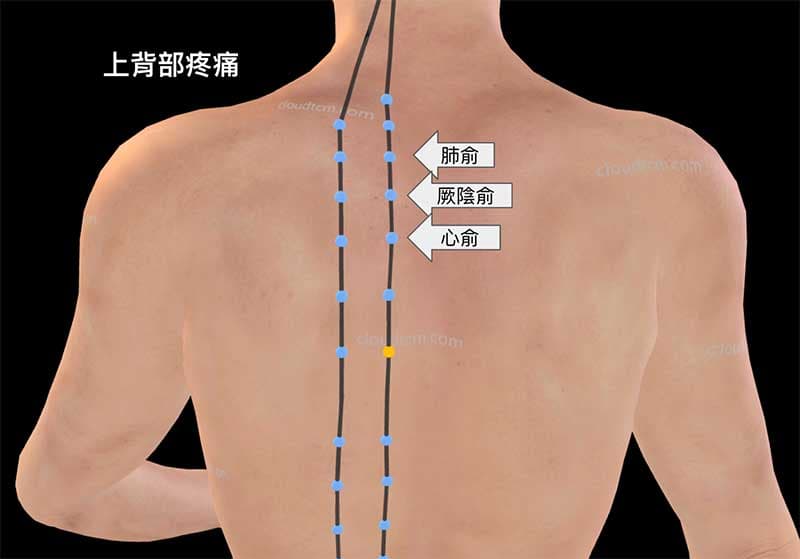 上背部疼痛主要俞穴是肺俞,厥陰俞,心俞