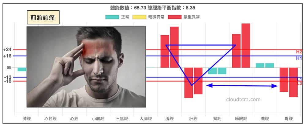 倒鐵三角經絡型態，也會出現前額痛