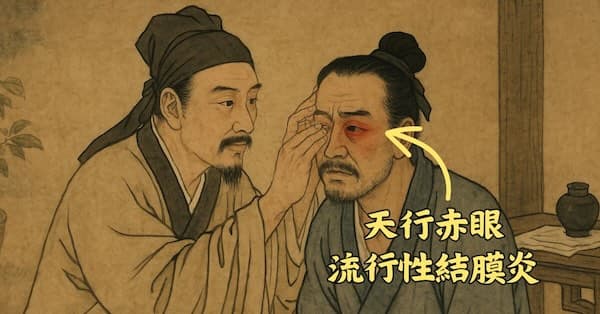 古代中國人發現天行赤眼，流行性結膜炎現象