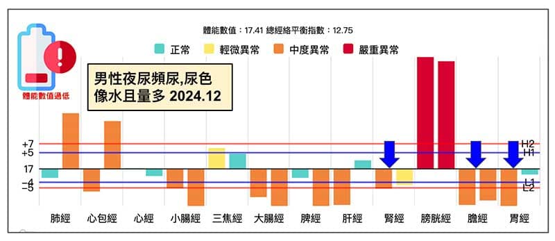 男性容易夜尿頻尿的經絡型態