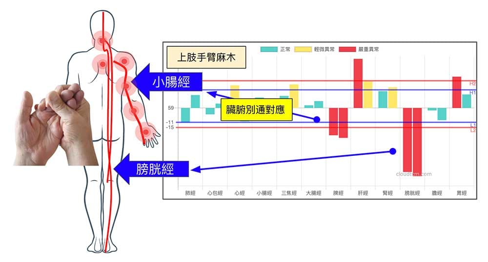 太陽經長期阻塞時，容易出現手麻