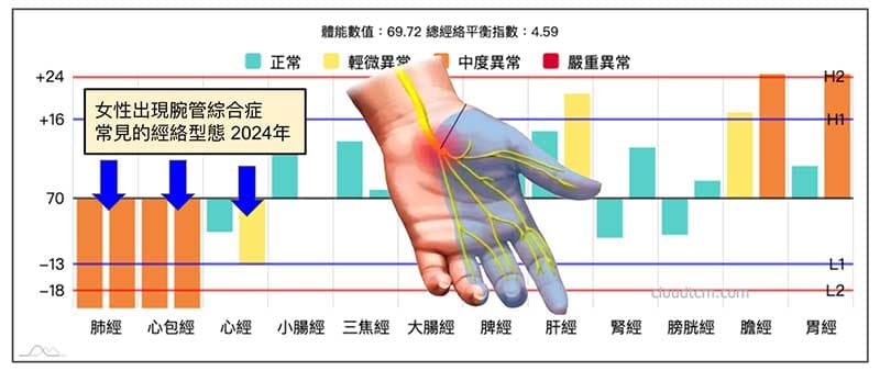 女性出現腕管綜合症，常見的經絡型態