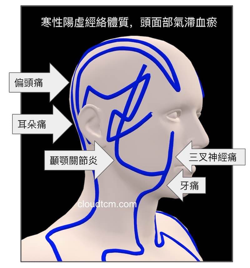 寒性體質的人，頭面部容易出現各種疼痛