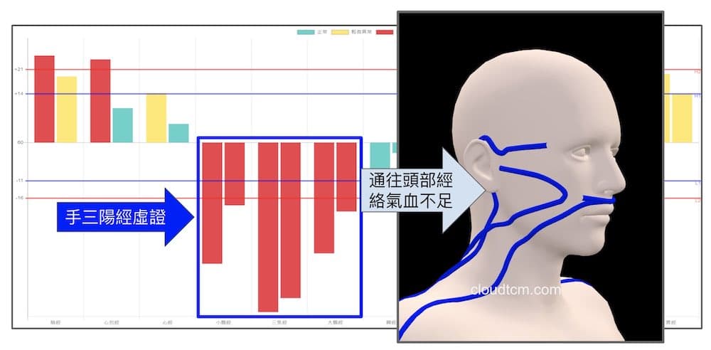 三陽經全部虛證相當少見，造成長年的暈眩現象