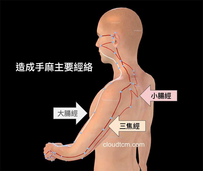 容易造成手麻的經絡