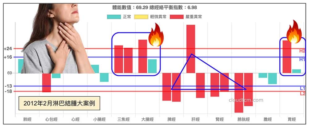 2022年2月淋巴結腫大經絡現象