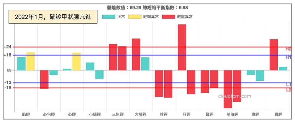 確診甲狀腺亢進經絡型態