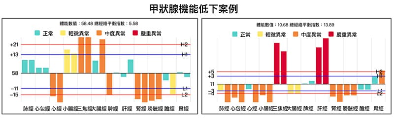 兩個甲狀腺低下案例