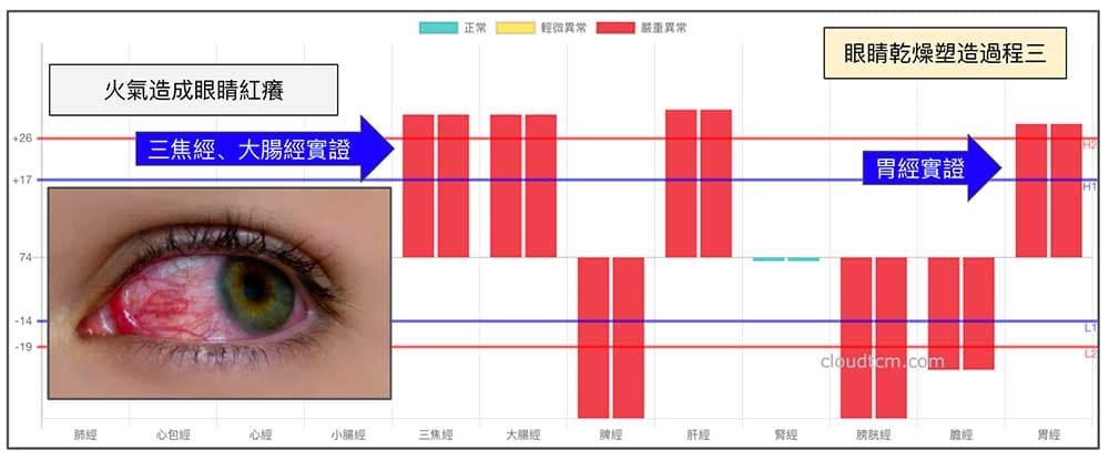 體內火氣開始出現