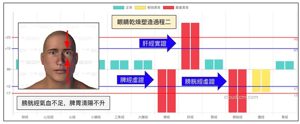 肝經實證之後，脾經與膀胱經能量迅速降低