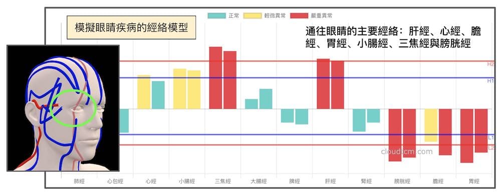 模擬眼睛疾病的經絡模型