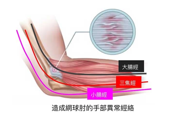 通往手肘外側主要是大腸、三焦與小腸經
