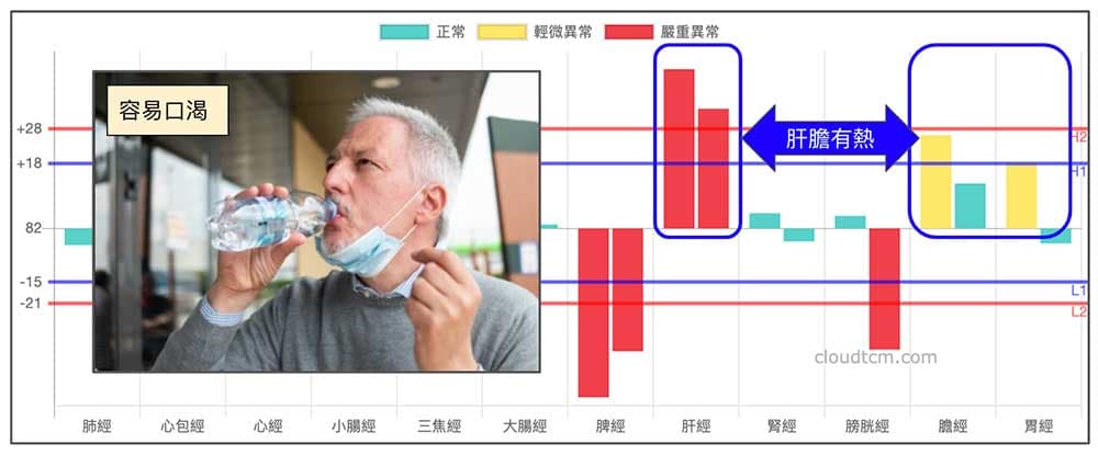 肝膽有熱，容易出現口渴