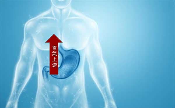 胃氣上逆是造成打嗝的主要原因
