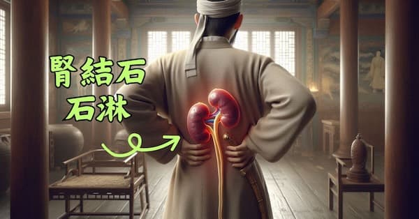腎結石在古代被稱為石淋