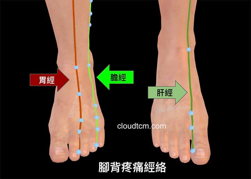造成腳背疼痛的經絡，主要是肝經、膽經與胃經