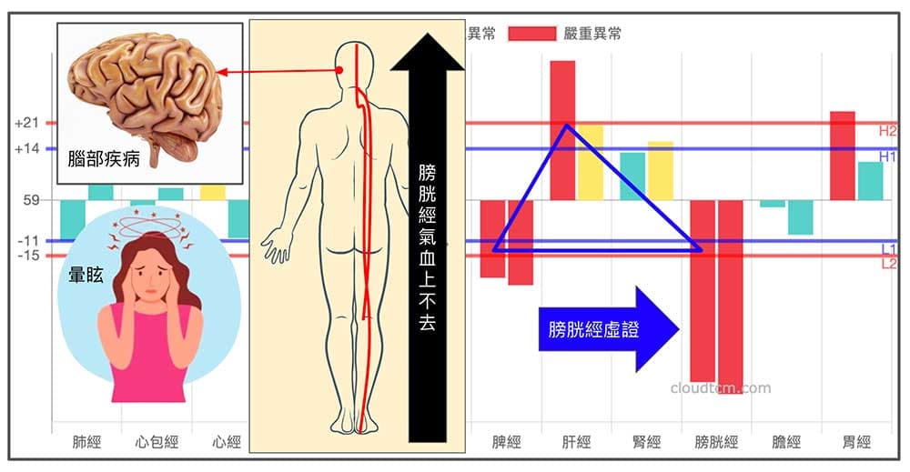 膀胱經阻塞是造成頭暈的最常見原因