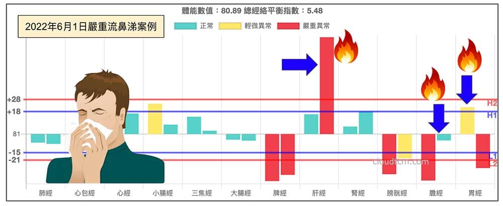夏天時膽經容易實證，出現流鼻涕