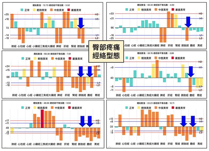 出現臀部疼痛的經絡型態，多數膀胱經、膽經虛證