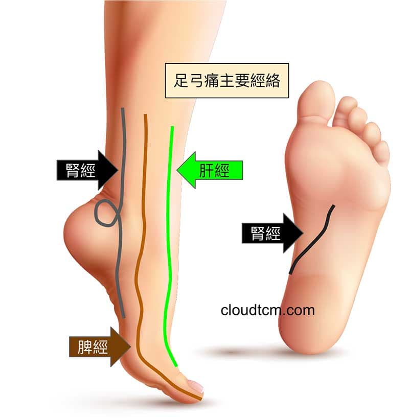 腳內側足弓痛與腎經密切相關