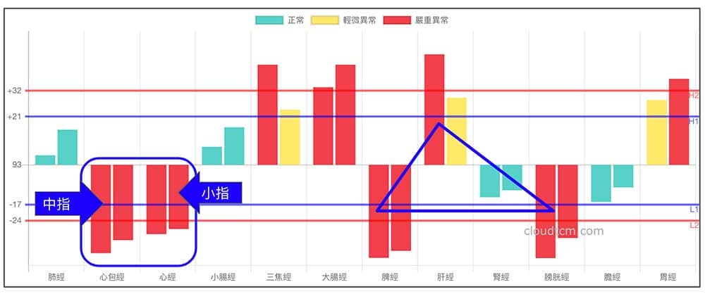 鐵三角經絡型態，有機會出現中指扳機指