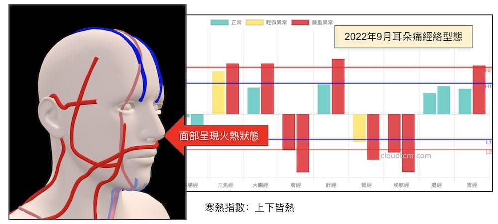 鐵三角經絡體質化熱的耳朵痛案例