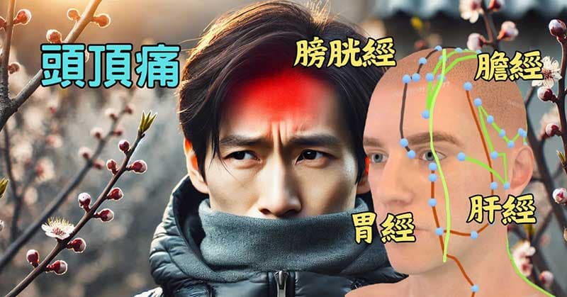 頭頂痛，與肝經、膀胱經、膽經與胃經有關聯