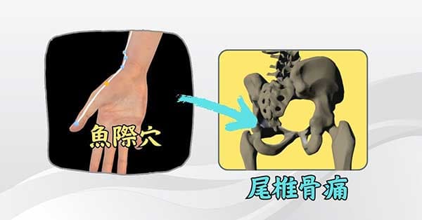 刺激魚際穴，可以改善尾椎骨痛