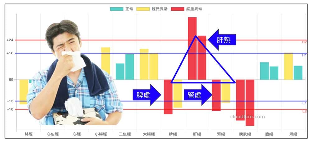 鐵三角經絡型態很容易出現鼻病