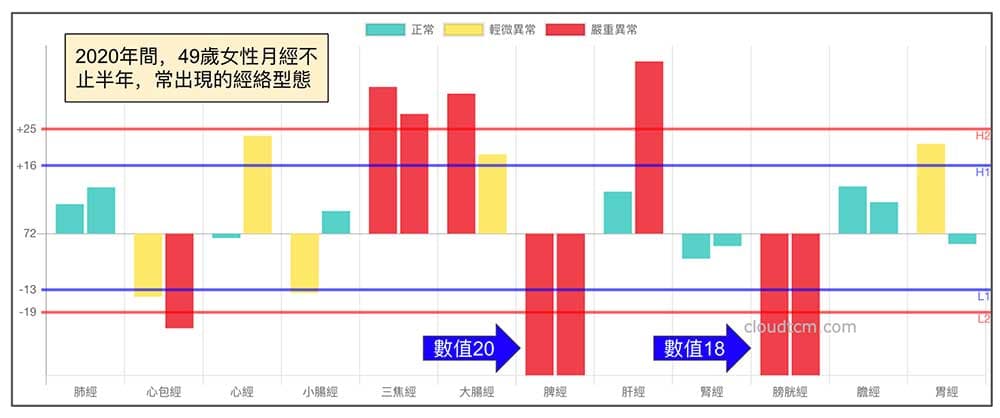 2020年月經不止長達半年以上