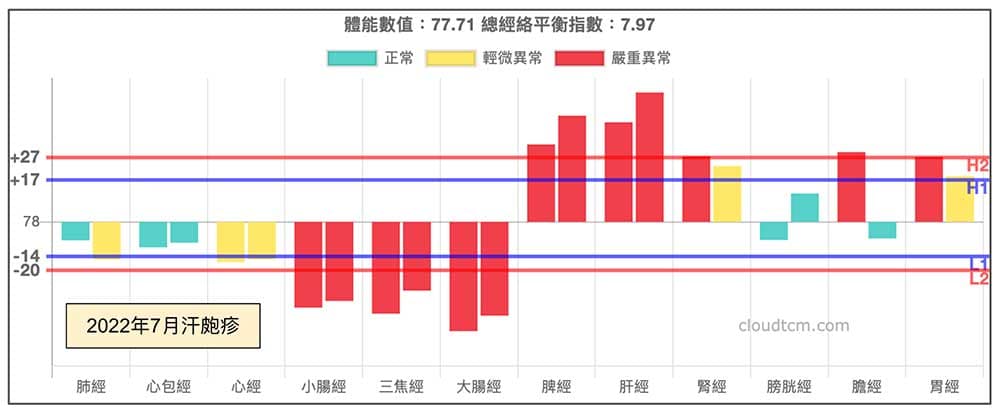 2022年7月愛喝冰水出來的汗皰疹