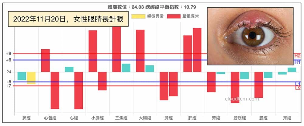 2022年11月，女性長針眼的經絡型態